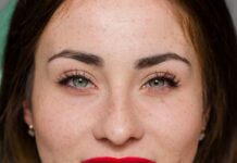 Когда и какие именно брекеты необходимо установить
