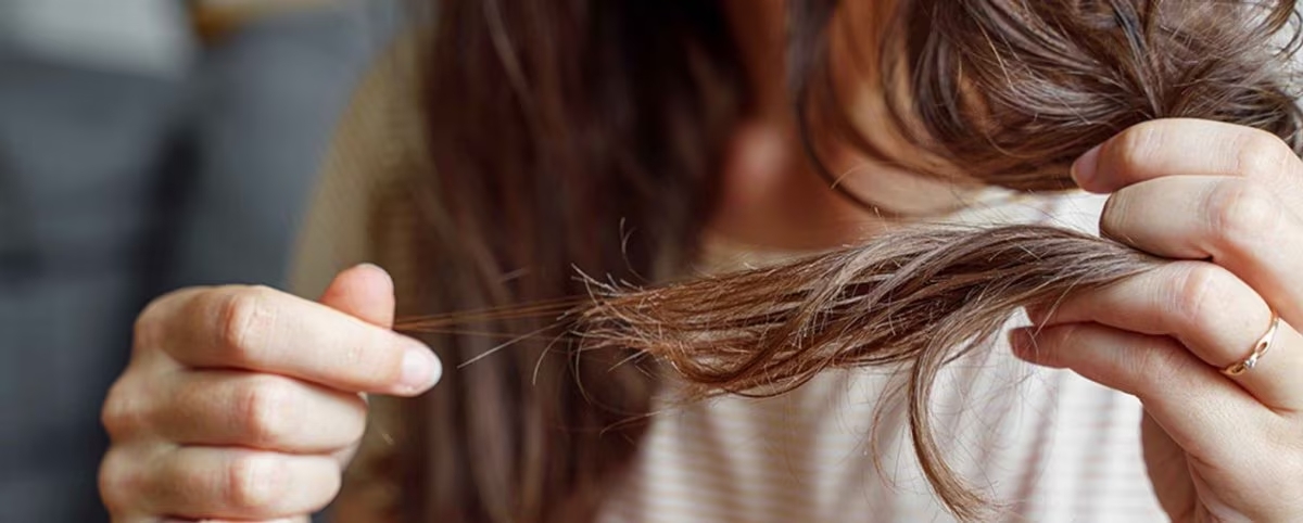 втрата волосся у жінки